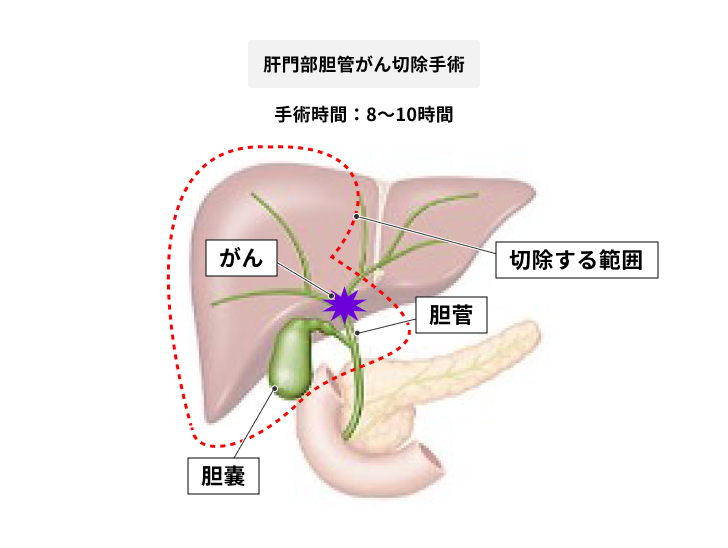 実績や技術がある医師による手術