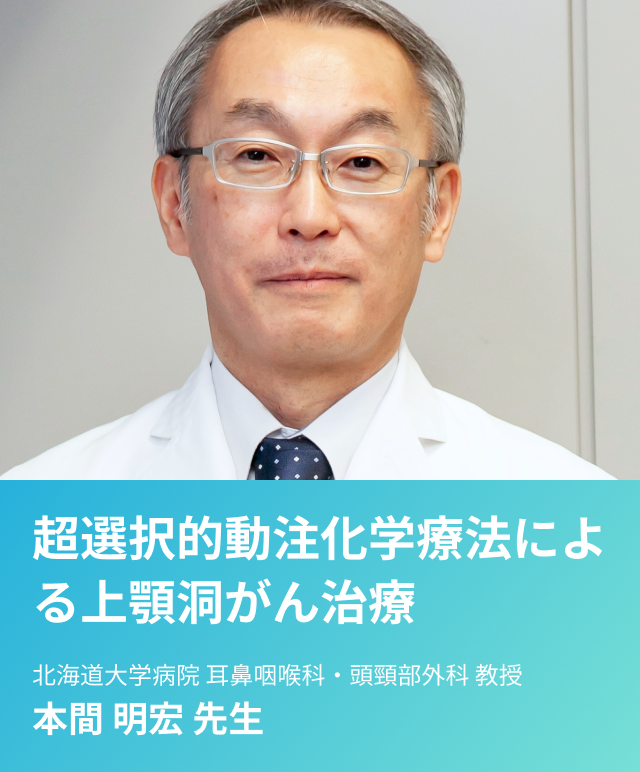 頭頸部がん〜超選択的動注化学療法での上顎洞がん治療〜 | 国立大学